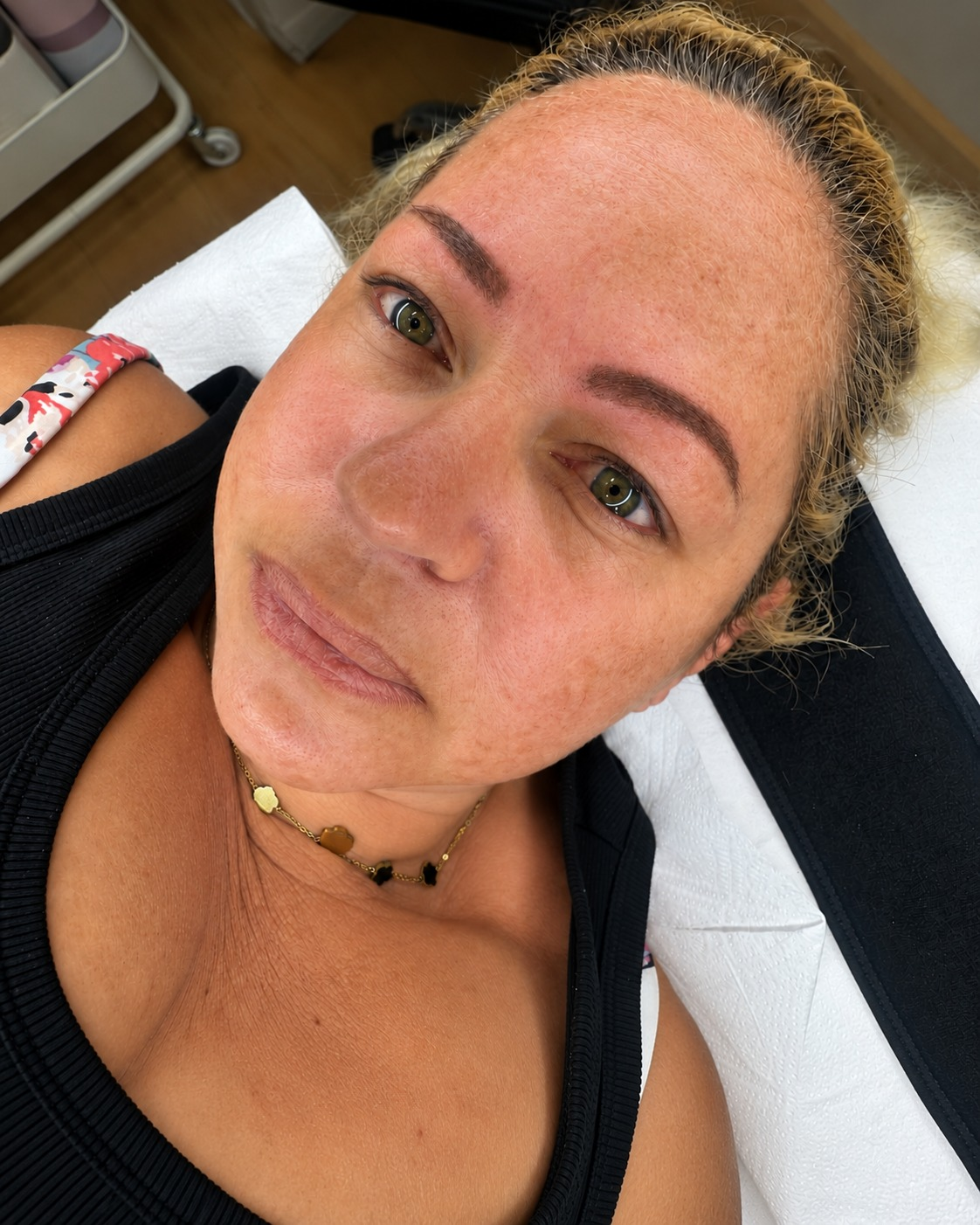 Sourcils après la restructuration